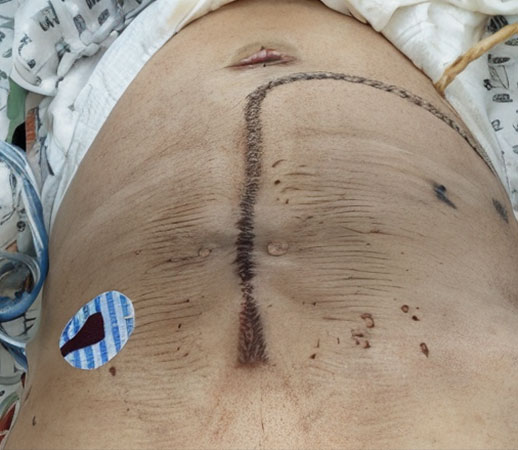 casos de exito ganados como abogado en negligencia medica en colombia boutique Legal