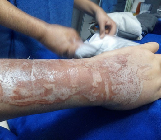 casos de exito ganados como abogado en negligencia medica en colombia boutique Legal