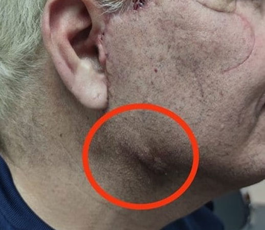 casos de exito ganados como abogado en negligencia medica en colombia boutique Legal